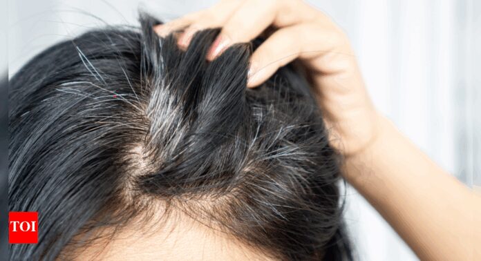 How to prevent premature greying of hair, the Ayurveda way